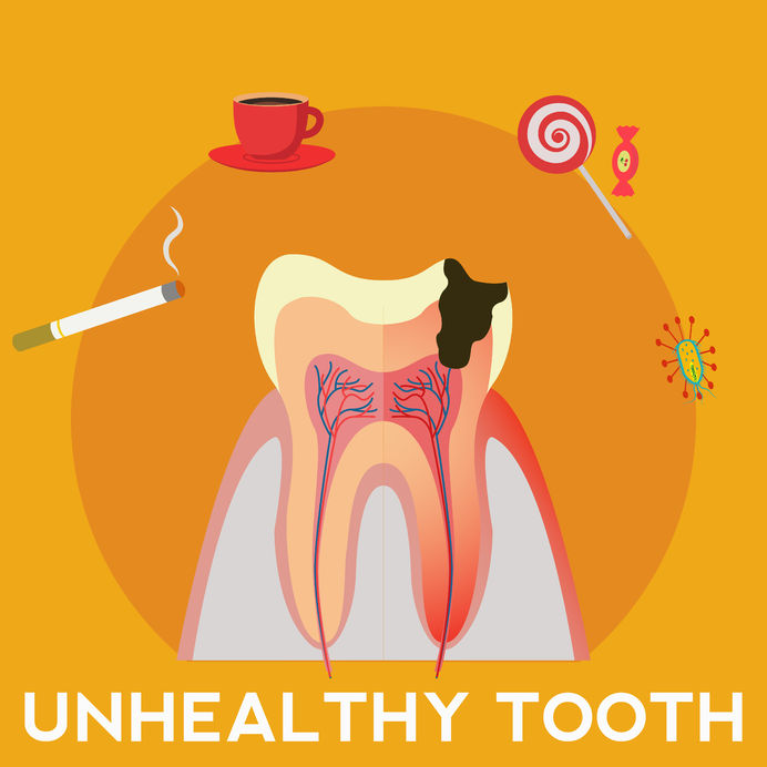 unhealthy tooth